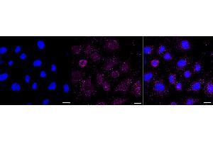 Immunocytochemical staining of Hela cells with GOPC antibody (ABIN7798796), 1:1,000).