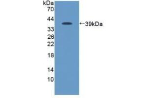 Detection of Recombinant Protein RPA096Ca01 with GST-tag using Anti-Glutathione S Transferase (GST) Tag Polyclonal Antibody (GST Antikörper  (AA 1-218))