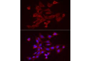 Immunofluorescence analysis of NIH/3T3 cells using  Rabbit pAb (ABIN7265439) at dilution of 1:25 (40x lens). (ADAMTS1 Antikörper  (AA 718-967))