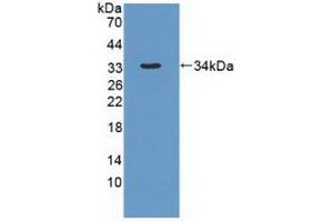 Detection of Recombinant DYNC1H1, Human using Polyclonal Antibody to Dynein, Cytoplasmic 1, Heavy Chain 1 (DYNC1H1) (DYNC1H1 Antikörper  (AA 20-285))