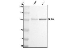 Western blot analysis of DDX58 using anti-DDX58 antibody (ABIN7604629).