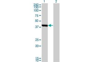 Western Blot analysis of SMS expression in transfected 293T cell line by SMS monoclonal antibody (M01), clone 1G6. (SMS Antikörper  (AA 1-366))