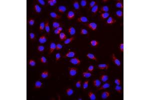 IF analysis of SGK1 using anti-SGK1 antibody (ABIN7603118). (SGK1 Antikörper  (N-Term))