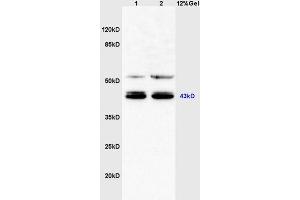 Mouse heart lysates probed with Anti C3orf21/XXYLT1 Polyclonal Antibody, Unconjugated (ABIN1385794) at 1:200 in 4 °C. (XXYLT1 Antikörper  (AA 120-165))