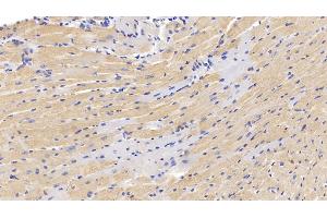 Detection of MUC5AC in Mouse Cardiac Muscle Tissue using Polyclonal Antibody to Mucin 5 Subtype AC (MUC5AC) (MUC5AC Antikörper  (AA 430-549))