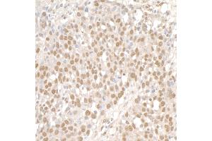 Immunohistochemistry (IHC) image for anti-Structural Maintenance of Chromosomes 1A (SMC1A) (C-Term) antibody (ABIN7453928)