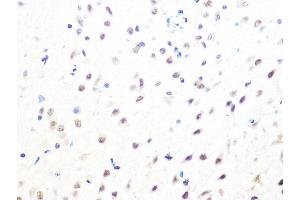 Immunohistochemistry (IHC) image for anti-MAD2 Mitotic Arrest Deficient-Like 2 (MAD2L2) antibody (ABIN1679325)