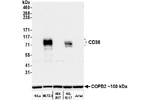 Western Blotting (WB) image for anti-CD36 (CD36) (AA 30-439) antibody (ABIN7449417)