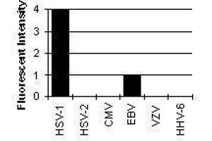 Cross Reactivity Results determined by IFA (HSV1 ICP0 Antikörper)