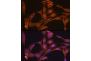 Immunofluorescence analysis of NIH-3T3 cells using CLOCK Rabbit mAb (ABIN7266414) at dilution of 1:100 (40x lens). (CLOCK Antikörper)