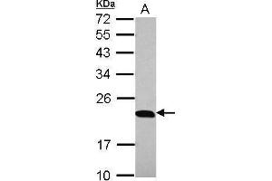 WB Image Sample (30 ug of whole cell lysate) A: 293T 12% SDS PAGE antibody diluted at 1:10000 (PTGES3 Antikörper)