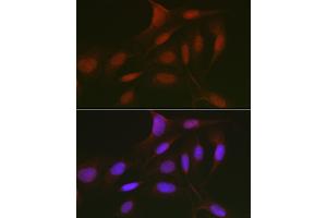 Immunofluorescence analysis of U2OS cells using RBL2 Rabbit pAb (ABIN7269943) at dilution of 1:50 (40x lens). (p130 Antikörper  (AA 100-200))