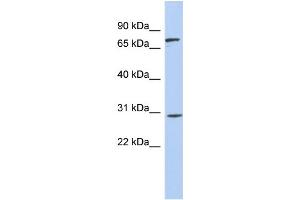 WB Suggested Anti-ZNF131 Antibody Titration:  0.