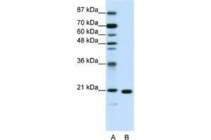 Western Blotting (WB) image for anti-Ribosomal Protein L9 (RPL9) antibody (ABIN2462050) (RPL9 Antikörper)