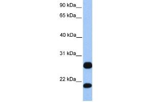 WB Suggested Anti-C1orf63 Antibody Titration:  0. (C1orf63 Antikörper  (C-Term))