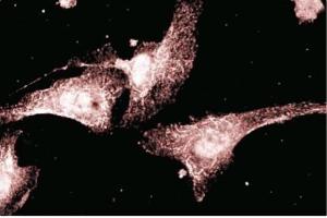 Immunofluorescent staining of endothelial cells. (AKAP5 Antikörper  (AA 180-427))