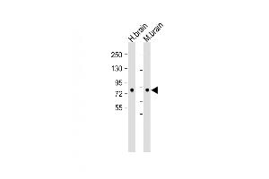 All lanes :DCKL1 Antibody (C-term) at 1:2000 dilution Lane 1: Human brain lysate Lane 2: Mouse brain lysate Lysates/proteins at 20 μg per lane. (DCLK1 Antikörper  (AA 690-720))