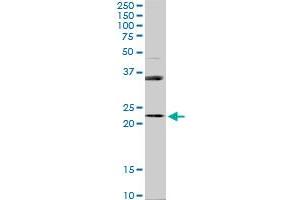 RAB31 monoclonal antibody (M03), clone 4D12. (RAB31 Antikörper  (AA 96-195))