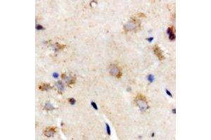Immunohistochemical analysis of Interferon lambda-3 staining in rat brain formalin fixed paraffin embedded tissue section. (IL28B Antikörper)