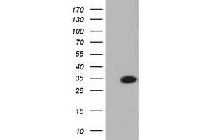 Western Blotting (WB) image for anti-Ketohexokinase (KHK) antibody (ABIN1499023) (Ketohexokinase Antikörper)