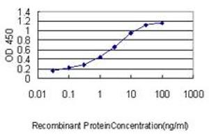 Detection limit for recombinant GST tagged SLA2 is approximately 0. (SLAP2 Antikörper  (AA 1-261))