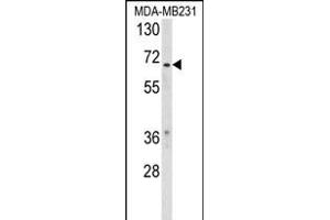 Western blot analysis of RXRB Antibody (Center) (ABIN653727 and ABIN2843034) in MDA-M cell line lysates (35 μg/lane). (Retinoid X Receptor beta Antikörper  (AA 256-284))