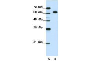 MGC42174 antibody used at 1. (DIS3L2 Antikörper  (N-Term))