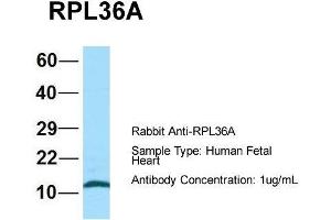 Host: Rabbit  Target Name: RPL36A  Sample Tissue: Human Fetal Heart  Antibody Dilution: 1. (RPL36AL Antikörper  (C-Term))