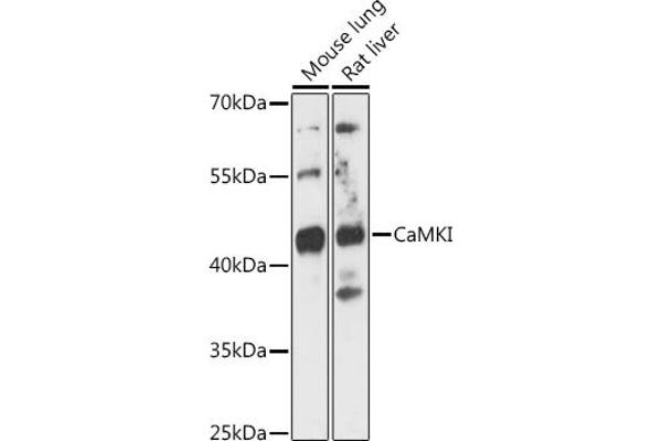 CAMK1 抗体  (AA 1-93)