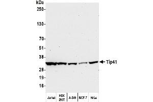 Western Blotting (WB) image for anti-TIP41-like protein (TIPRL) (C-Term) antibody (ABIN7453900) (TIPRL Antikörper  (C-Term))