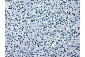 Immunohistochemistry (IHC) image for anti-Budding Uninhibited By Benzimidazoles 1 Homolog beta (Yeast) (BUB1B) antibody (ABIN1496995) (BUB1B Antikörper)