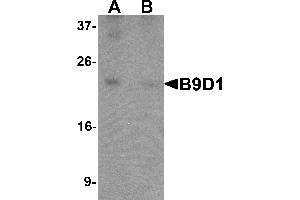 Western blot analysis of B9D1 in 293 cell lysate with B9D1 antibody at 1 µg/mL in (A) the absence and (B) the presence of blocking peptide.