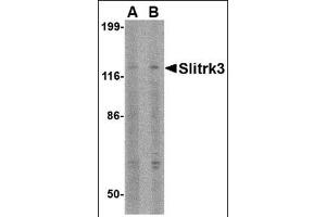 Western blot analysis of Slitrk3 in SK-N-SH cell lysate with this product at (A) 0.