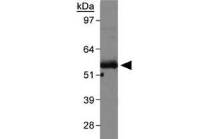 Western blot analysis of Slc2a9 in mouse kidney membrane with Slc2a9 polyclonal antibody .