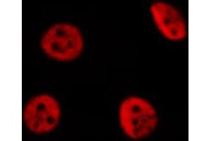 ABIN6274259 staining Hela cells by IF/ICC. (YAP1 Antikörper  (Internal Region))
