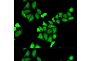 Immunofluorescence analysis of A549 cells using GALE Polyclonal Antibody (GALE Antikörper)