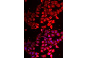 Immunofluorescence analysis of HeLa cells using CMPK1 antibody (ABIN5973940). (Cytidine Monophosphate (UMP-CMP) Kinase 1, Cytosolic (CMPK1) Antikörper)