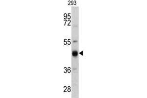 Western Blotting (WB) image for anti-Keratin 13 (KRT13) antibody (ABIN3002761) (Cytokeratin 13 Antikörper)