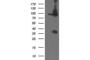 Western Blotting (WB) image for anti-Proteasome (Prosome, Macropain) 26S Subunit, Non-ATPase, 2 (PSMD2) antibody (ABIN1500480) (PSMD2 Antikörper)
