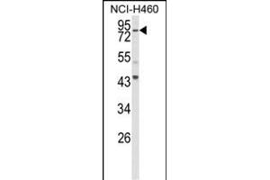 Western blot analysis of SPG20 Antibody (N-term) (ABIN652983 and ABIN2842623) in NCI- cell line lysates (35 μg/lane). (SPG20 Antikörper  (N-Term))