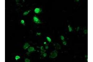 Anti-MAGEB18 mouse monoclonal antibody (ABIN2454279) immunofluorescent staining of COS7 cells transiently transfected by pCMV6-ENTRY MAGEB18 (RC206329). (MAGEB18 Antikörper)
