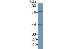 Western blot analysis of Rat Liver lysate, using Rat GALT Antibody (1 µg/ml) and HRP-conjugated Goat Anti-Rabbit antibody ( (GALT Antikörper  (AA 1-379))