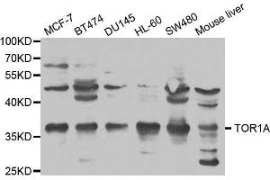 Western blot analysis of extracts of various cell lines, using TOR1A antibody. (TOR1A Antikörper  (AA 63-332))