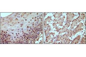 Immunohistochemical staining of paraffin-embedded human normal esophagus (A) and stomach (B) tissue, showing nucleus localization using Rb mouse mAb with DAB staining. (Retinoblastoma 1 Antikörper)