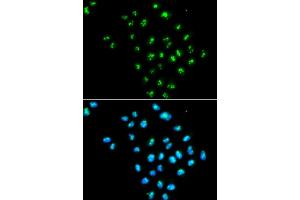 Immunofluorescence analysis of MCF7 cell using EIF6 antibody. (EIF6 Antikörper)