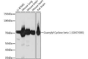 Western blot analysis of extracts of various cell lines, using Guanylyl Cyclase beta 1 (GUCY1B3) (GUCY1B3) Rabbit mAb (ABIN7267551) at 1:1000 dilution. (GUCY1B3 Antikörper)