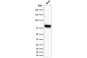 Western Blotting (WB) image for anti-Catenin (Cadherin-Associated Protein), beta 1, 88kDa (CTNNB1) antibody (ABIN6939211)