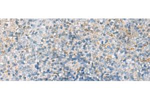 Immunohistochemistry of paraffin-embedded Human tonsil tissue using EMILIN1 Polyclonal Antibody at dilution of 1:70(x200)