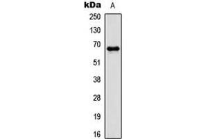 Western blot analysis of PAK1 (pT212) expression in HCT116 (A) whole cell lysates. (PAK1 Antikörper  (pSer212))