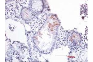 Immunohistochemistry image of B-Defensin 2 staining in paraffn section of human colon resection tissue.